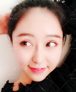 美萊案例呂思佳對(duì)比圖后