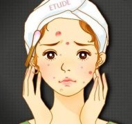 經(jīng)常長(zhǎng)痘，美萊果酸祛痘效果怎么樣