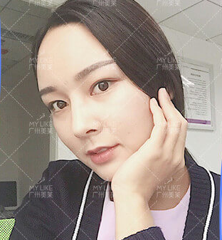 廣州韓式隆鼻手術(shù)多少錢(qián)