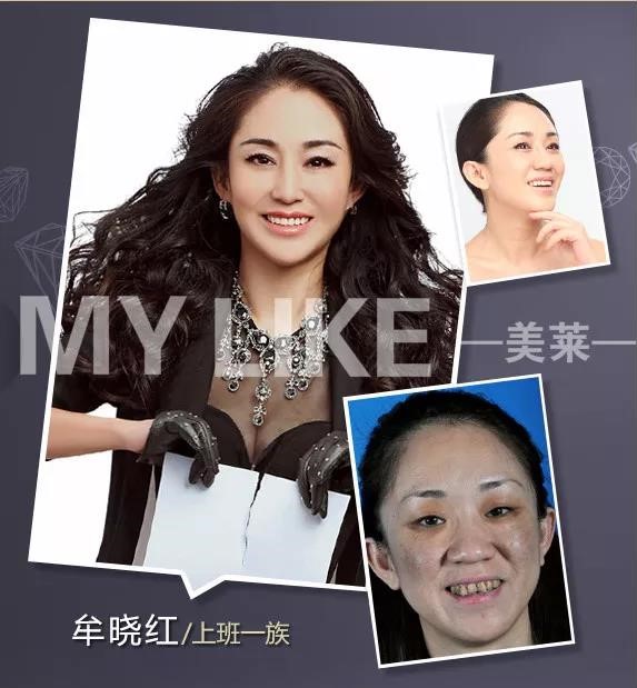 化妝品會讓黃褐斑增長嗎，預(yù)防黃褐斑有哪些方法