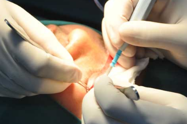 深圳哪家醫(yī)院做雙眼皮失敗修復效果好呢