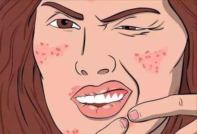 為什么額頭會(huì)長(zhǎng)痘，怎么祛除？