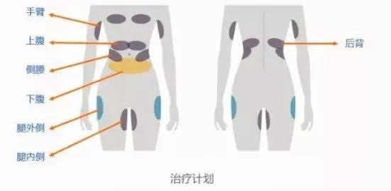 秋冬美麗不打折！讓美萊曹國靖醫(yī)師帶你一起【晶準(zhǔn)減脂 酷塑體線】