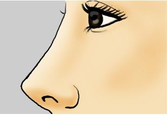 <a href='/cq/' target='_blank'><u>重慶美萊</u></a>玻尿酸隆鼻價(jià)格貴嗎？