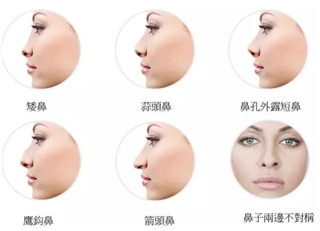 打玻尿酸鼻子會變寬，是不是真的？