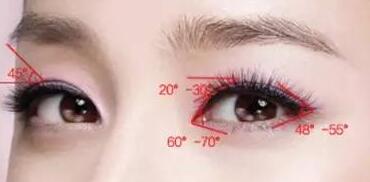 做開(kāi)眼角手術(shù)失敗的風(fēng)險(xiǎn)大嗎