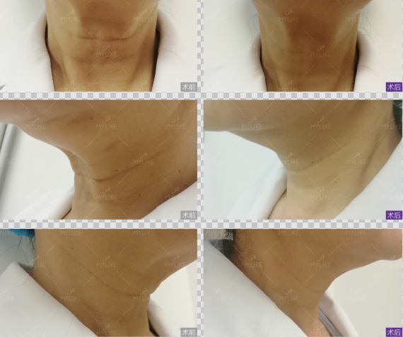 優(yōu)品聚獻(xiàn)·超級(jí)新品周|這份爆款清單務(wù)必收下！