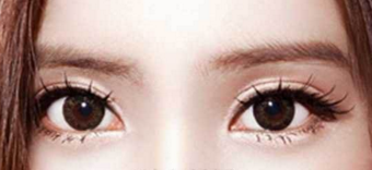 開眼角會(huì)留疤嗎