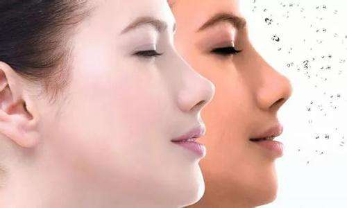 90后追捧的整容項目推薦，你喜歡什么？