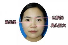 蘇州做韓式隆鼻手術(shù)要多少錢