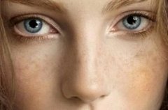 廣州去色斑大概多少錢(qián)