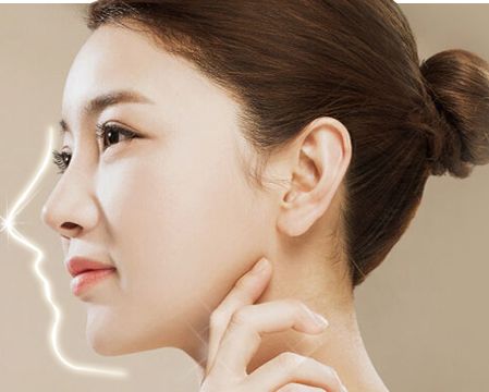 剛滿18歲的女生能去做玻尿酸隆鼻嗎？有什么危害嗎？