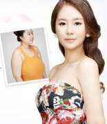 廣州做自體脂肪隆胸多少錢？