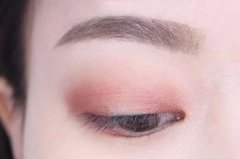 成都做全切雙眼皮適合哪些人？