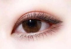 上海做雙眼皮價格一般是多少？