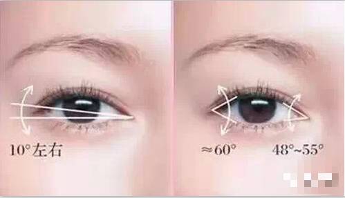 北京割雙眼皮有幾種方法？那種效果好？