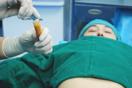 吸脂豐胸多少錢(qián)