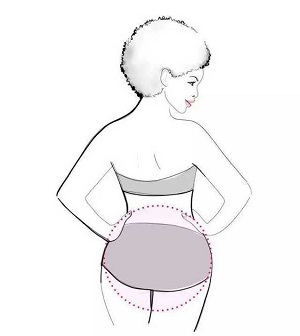 重慶做臀部吸脂減肥有哪些要注意的方面?