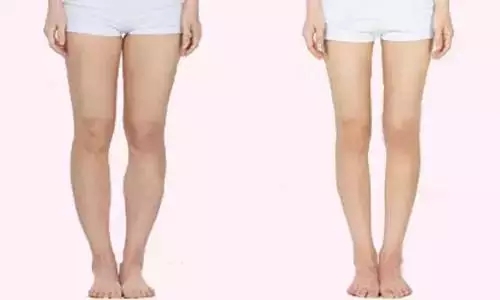 <a href='/cq/' target='_blank'><u>重慶美萊</u></a>做抽脂手術(shù)怎么樣?