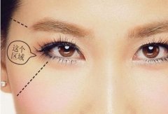 武漢做豐太陽穴多少錢？