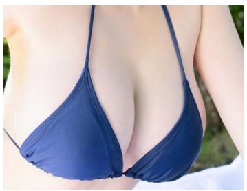 杭州做自體脂肪隆胸術(shù)創(chuàng)傷大嗎？