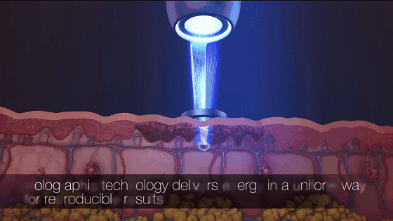 關(guān)于黃褐斑，你了解多少？