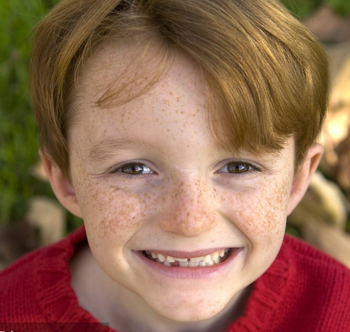 如何去臉上的斑比較有效?