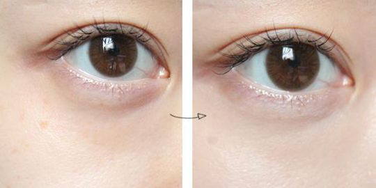 愛美女生如何消除黑眼圈？