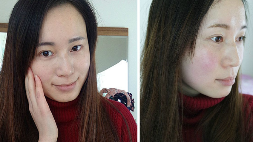 快速祛斑的方法有哪些？