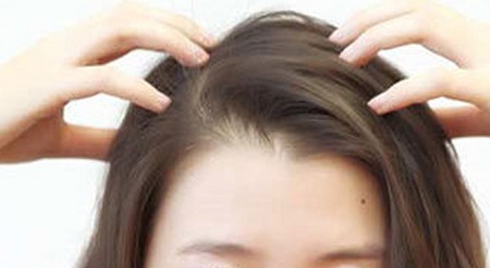 不做禿頭，掉發(fā)嚴(yán)重趕緊解決