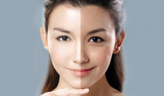 光子嫩膚價格是多少？