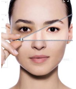 臉部吸脂是受歡迎的瘦臉方法嗎？