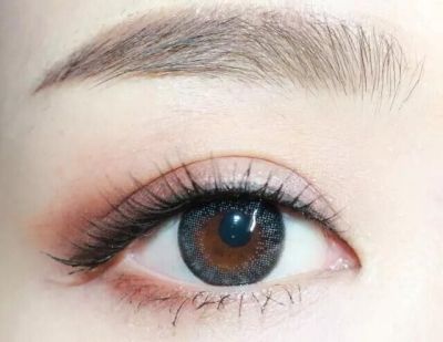 埋線雙眼皮術后怎么護理？