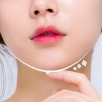 玻尿酸填充面頰效果怎么樣?