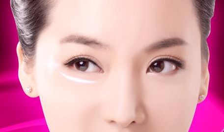 手術(shù)去眼袋要多久能恢復(fù)？