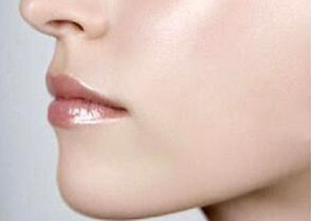 唇腭裂整容多少錢(qián)