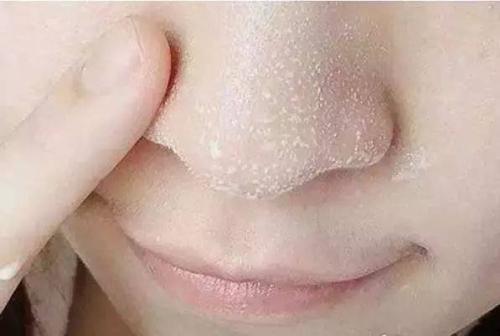 深圳做鼻頭整形要多少錢？