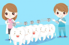 什么情況下需要做牙齒矯正呢？