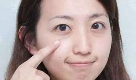 割雙眼皮有哪些類型呢?