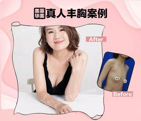 “從小喝到大”的椰汁能豐胸？