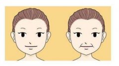 鄭州注射去除法令紋那種效果好？