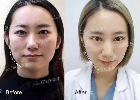 素顏邋遢老態(tài)，被嘲貴圈“照騙”！