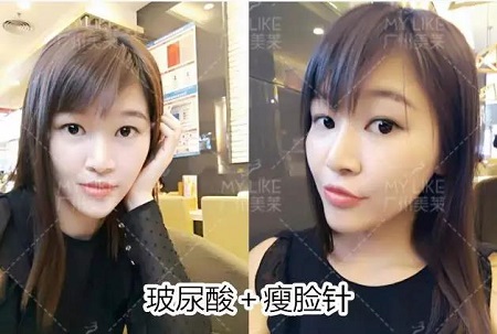 微調(diào)效果到底有多美？