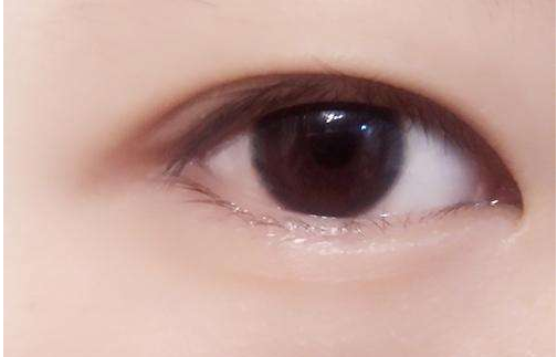 雙眼皮無能為力的時候，竟是遭遇了這些問題？