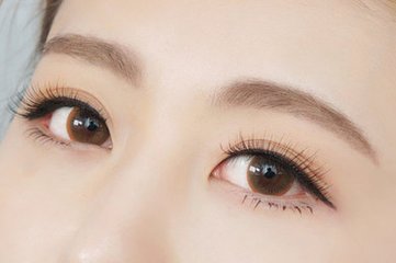 武漢切開法雙眼皮多少錢？