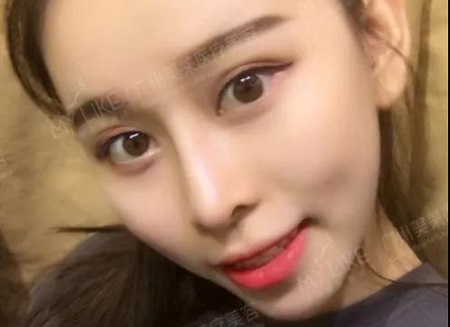 案例親測示范捏鼻！