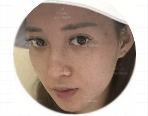 一言不合就爛臉，直到我遇到了舒敏之星！