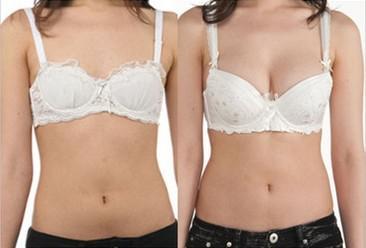 武漢豐胸注射副作用如何預防？