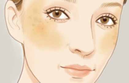 南京激光美容祛斑好不好？