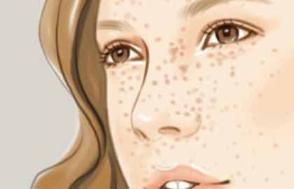 天津激光祛斑手術(shù)的價(jià)格是多少？